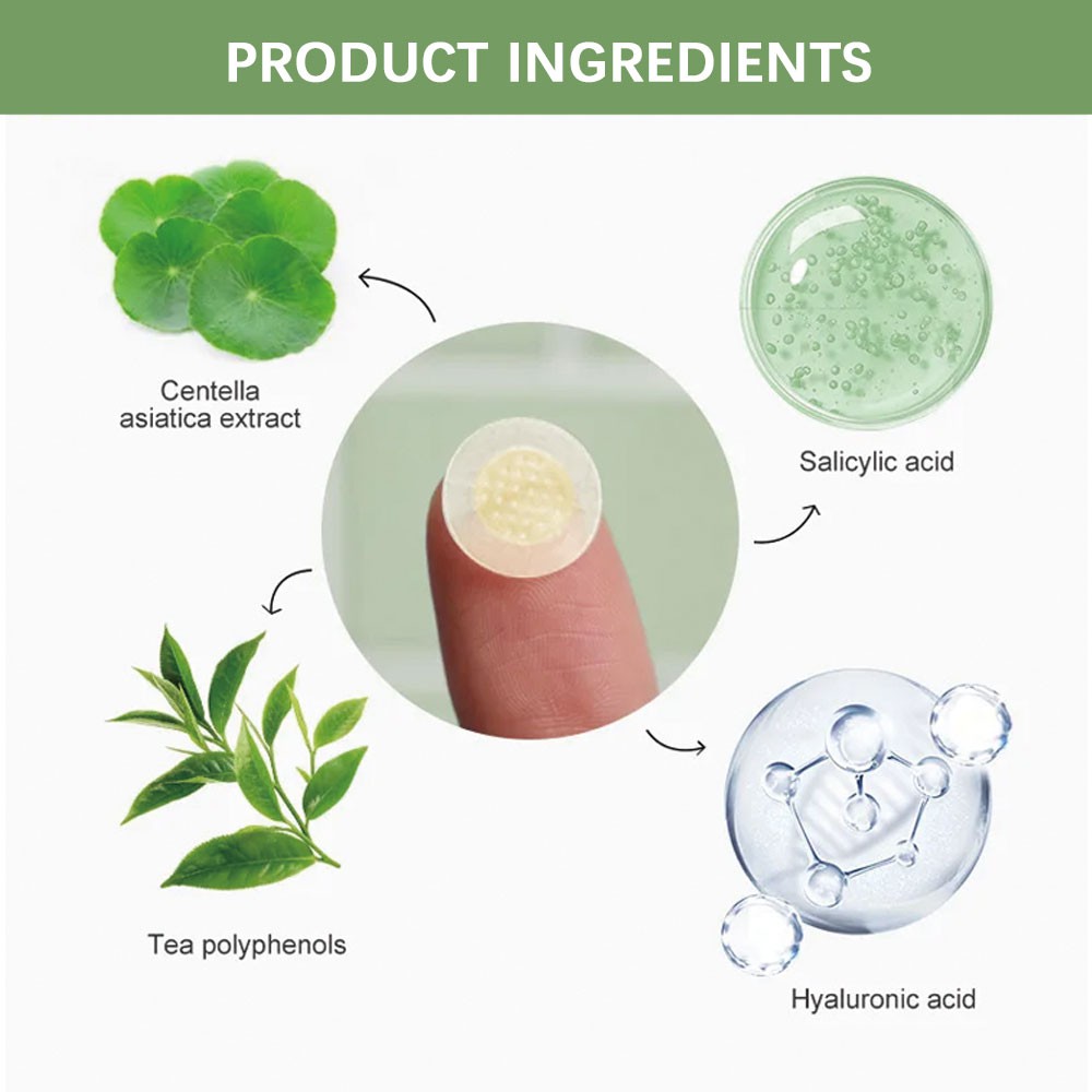 Microneedle acne patches Microneedle acne patches