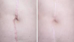 info-296-170